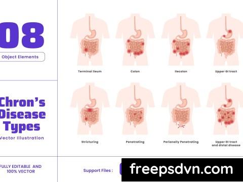 Chrons Disease Human Body Organ Treatment LGYL2FZ 0